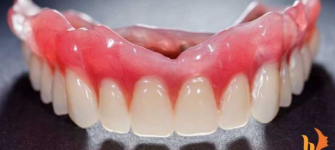 Trồng răng giả có biến chứng gì không ?