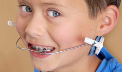 Hàm Headgear khi niềng răng – chỉnh nha cho trẻ em