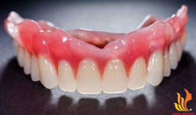 Trồng răng giả có biến chứng gì không ?